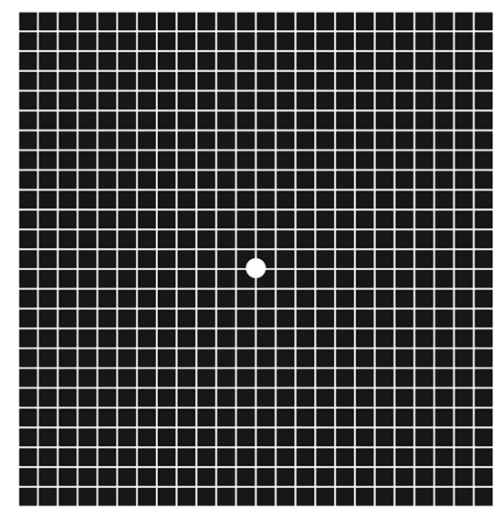 Amsler-Gittertest zur Prüfung der Netzhautfunktion